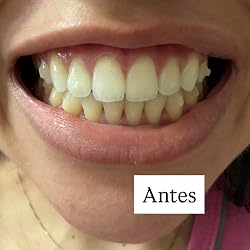 Cliente 2 usando a Pasta Roxa Clareadora